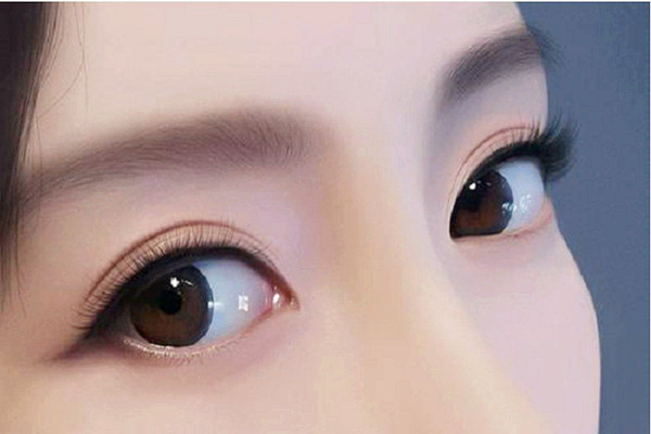 雙眼皮埋線(xiàn)后多久可以沾水 雙眼皮埋線(xiàn)后多久可以化妝