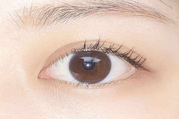 雙眼皮埋線(xiàn)后多久可以沾水 雙眼皮埋線(xiàn)后多久可以化妝