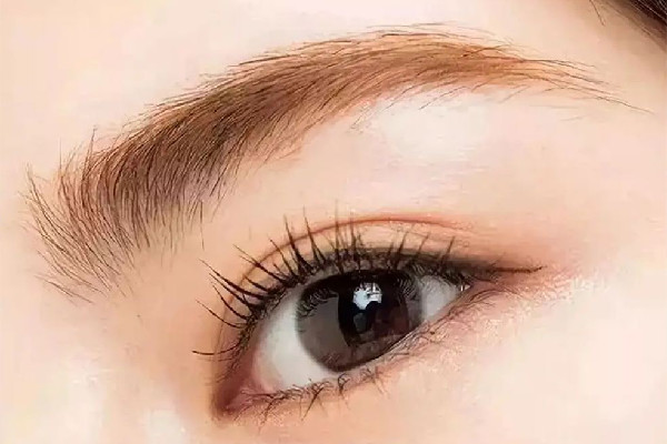 激光洗眉后的紅印怎么樣能快速消除 激光洗眉后多久能恢復正常膚色