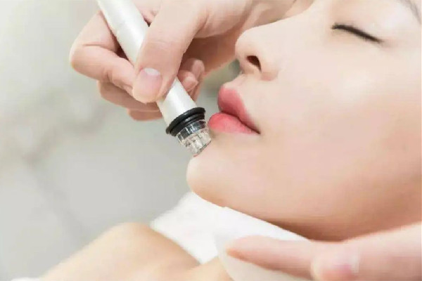 后湖SOR索爾祛痘?面部肌膚科學管理小氣泡項目感覺好嗎 小氣泡有收縮毛孔作用嗎