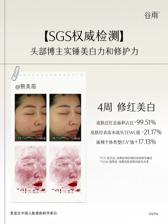 黃氣蔓延到脖子？用了這個成分從此告別“粉底臉-暗沉頸”社死現(xiàn)場